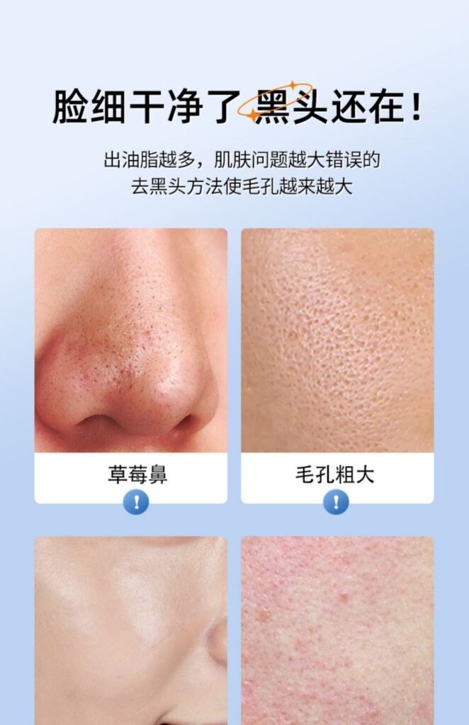دستگاه تمیز کننده جوش صورت برند کونکا